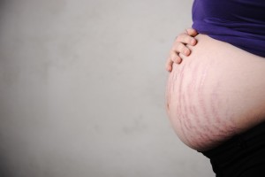 Những vấn đề về da thường gặp ở phụ nữ sau sinh