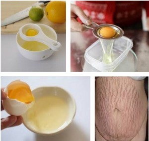 Cách chữa trị rạn da của trứng gà làm da sáng căng mịn sau 1 tuần